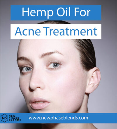 Hemp Oil for Acne Treatment Featured