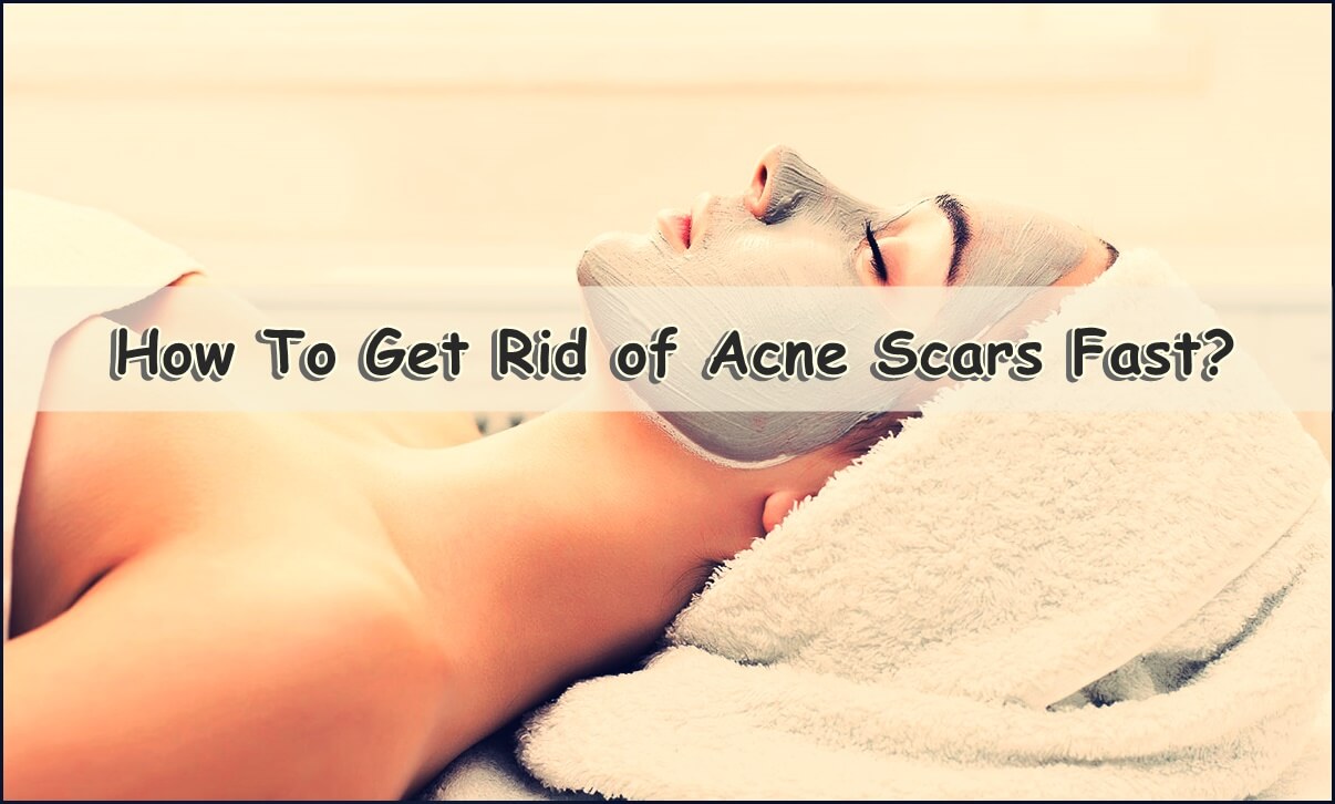 How To Get Rid Of Acne Fast