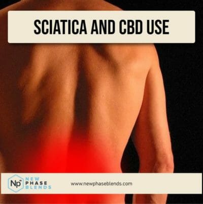 cbd for sciatica featured image