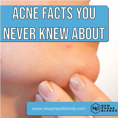 acne facts featured