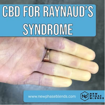 cbd for raynauds featured