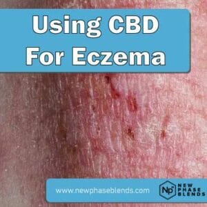 Cbd For Eczema Featured Image