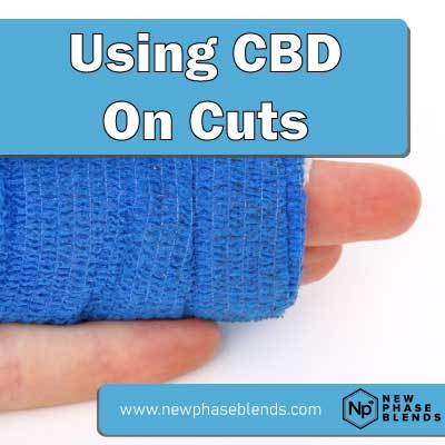 CBD for cuts featured